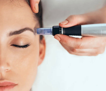 "Penna" microneedling