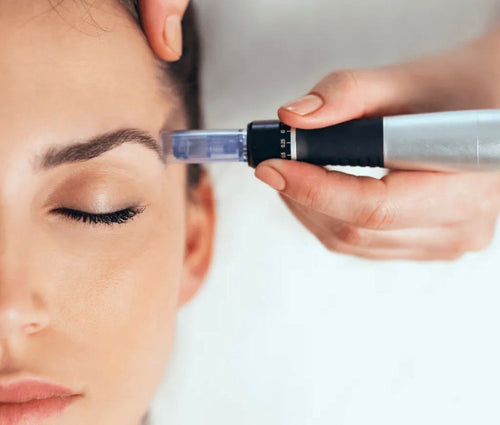 "Penna" microneedling